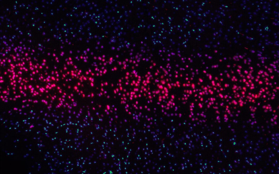 Pericytes and Endothelial Precursor Cells: Cellular Interactions and Contributions to Malignancy