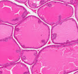 PROSTATE