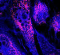mesenchymal courtesy: Mesenchymal Stem Cells (MSCs) in the Era of Regenerative Medicine December 16, 2019 By Cade Hildreth (CEO)